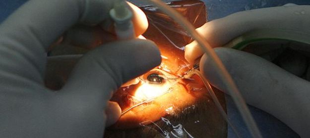PREMIUM CATARACT & IOL